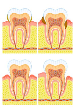 Internal structure of tooth clipart