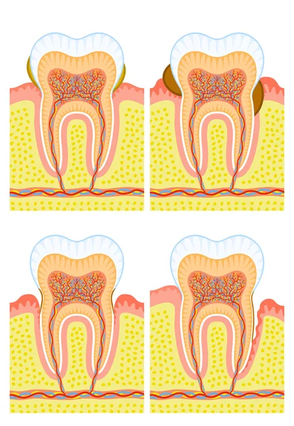 Struttura interna del dente — Vettoriale Stock