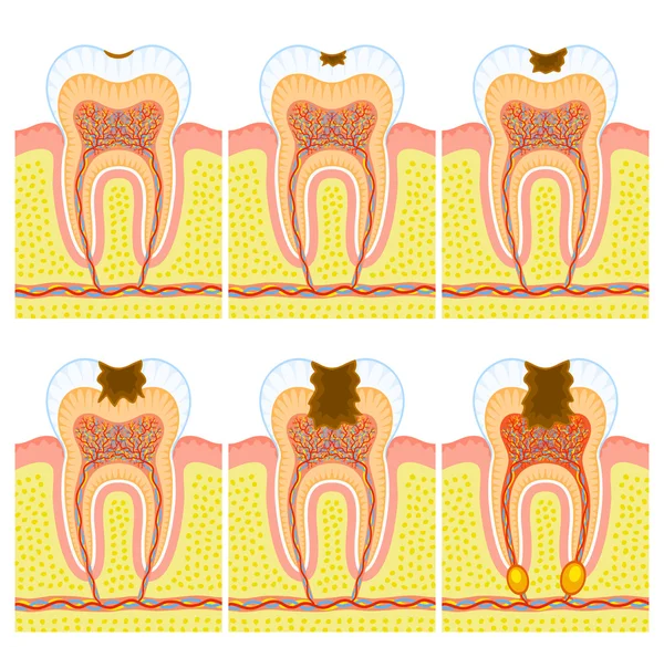 牙齿的内部结构 — 图库矢量图片#