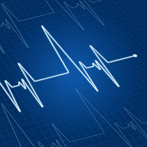 Pulso cardíaco na tela — Vetor de Stock
