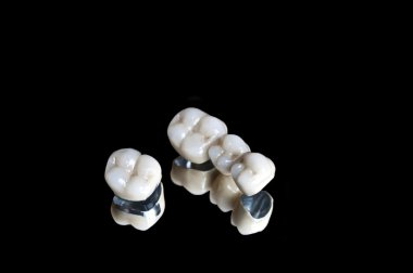 Ceramic dental crowns clipart