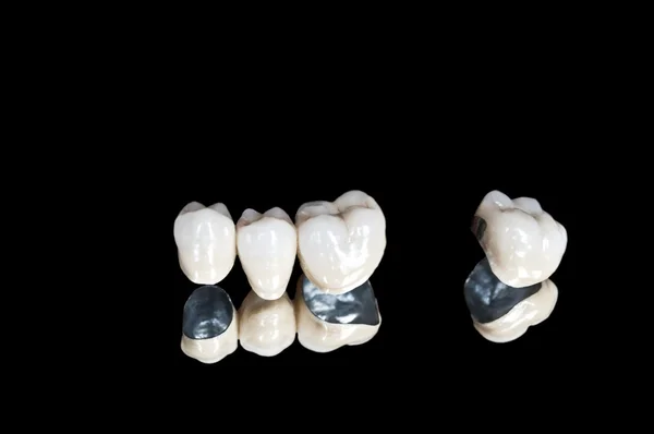 Керамические зубные коронки — стоковое фото