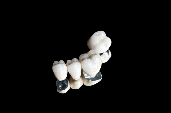 Keramické zubní korunky — Stock fotografie