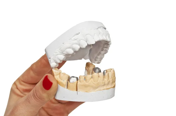Dents model in dentists hands — Stock Photo, Image