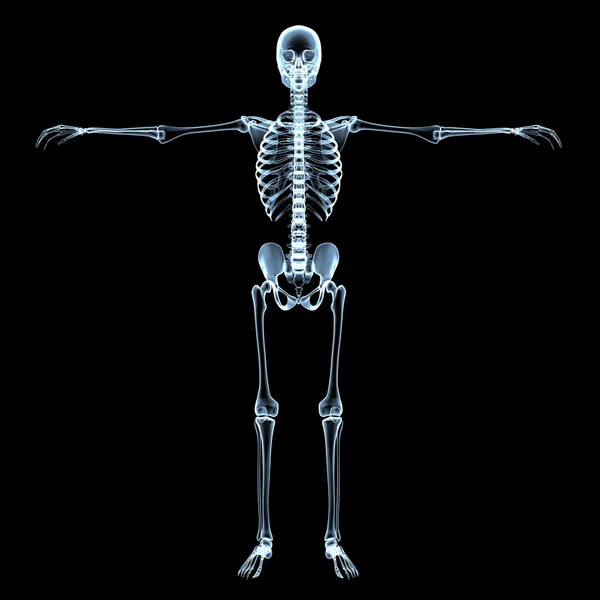 Рентгеновский снимок скелета человека — стоковое фото
