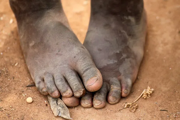 Ноги африканского ребенка — стоковое фото