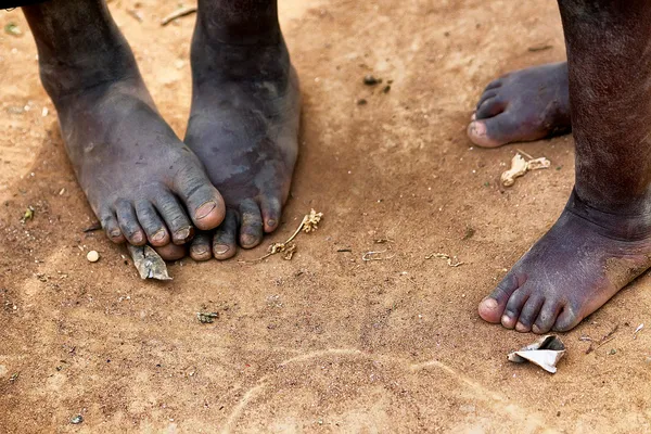 Feet of the african children — Stock Photo, Image