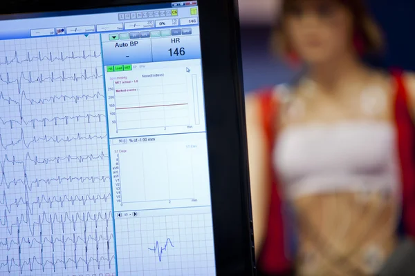 Cardiogram — Stock Photo, Image