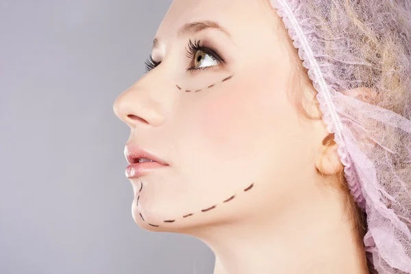 Iniezione di botox cosmetico nel viso femminile. — Foto Stock