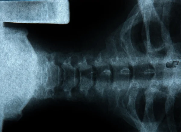 Bionic Man Profile on X-Ray — Stock Photo, Image