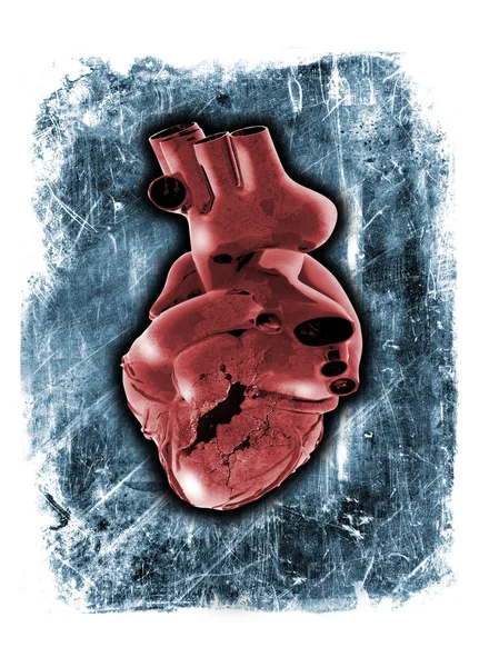 Broken human heart — Stock Photo © maninblack #10256730