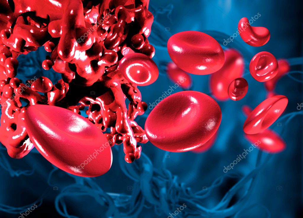 Blood clot — Stock Photo © maninblack #10256783