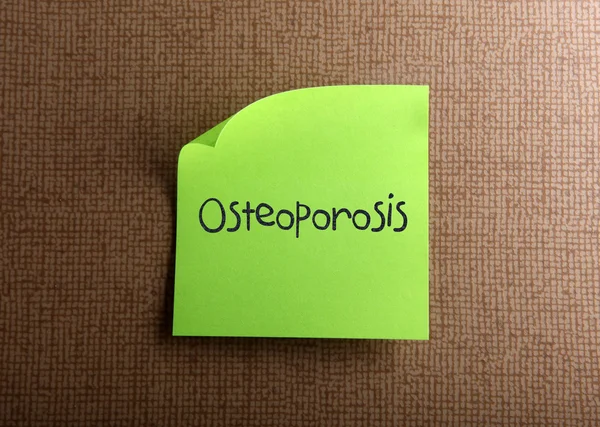 Остеопороз — стокове фото