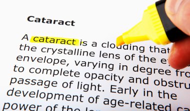 Cataract clipart