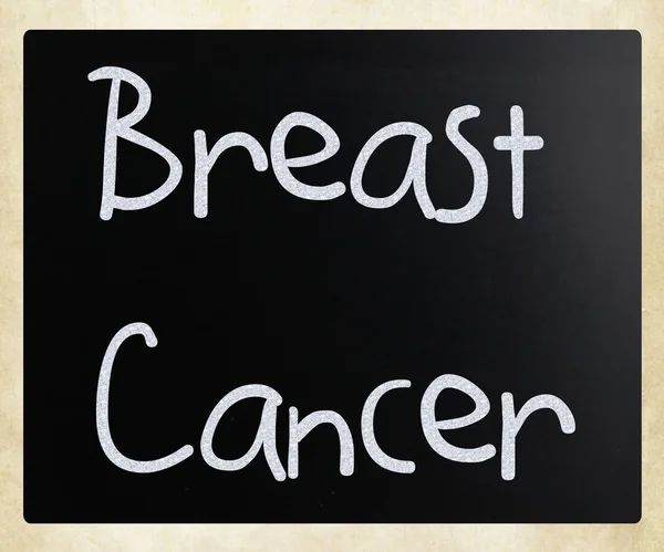 Καρκίνος του μαστού — Φωτογραφία Αρχείου