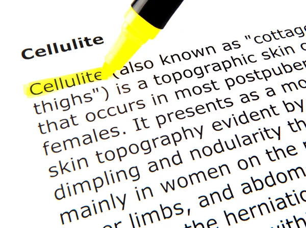 Celulite — Fotografia de Stock