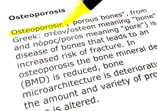 Osteoporóza — Stock fotografie