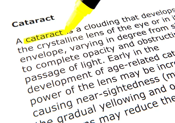 Cataracte — Photo