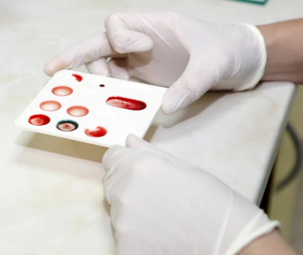 Blood Test — Stock Photo, Image