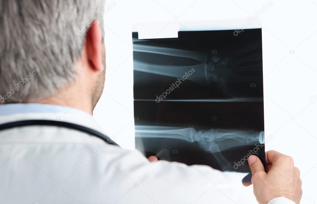 Checking an x ray