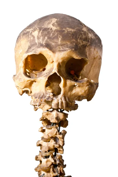 Grunge 人类头骨 — 图库照片