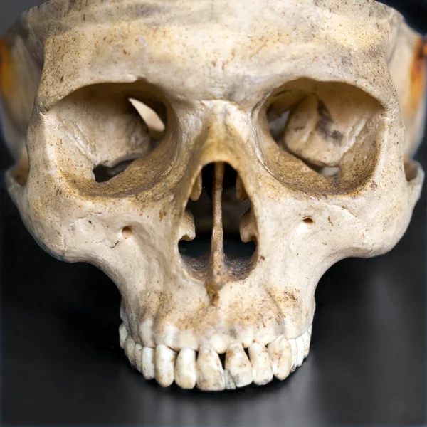 Большой череп человека — стоковое фото