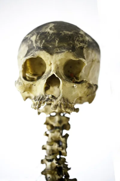 Grunge 人类头骨 — 图库照片