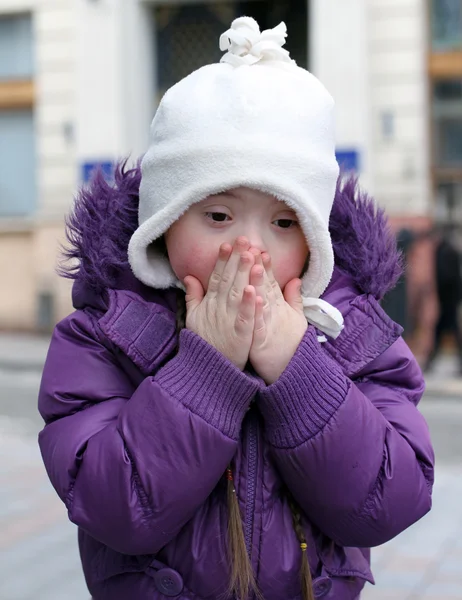 Маленькая напуганная девочка прячет лицо — стоковое фото