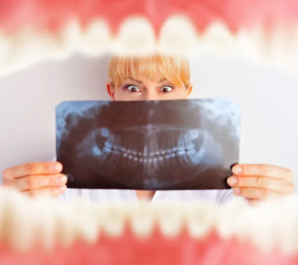 Bouche avec dents de l'intérieur et dentiste tenant des résultats de rayons X et très surpris — Photo