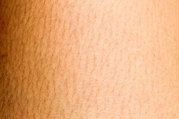 Cabelos na pele das mulheres — Fotografia de Stock