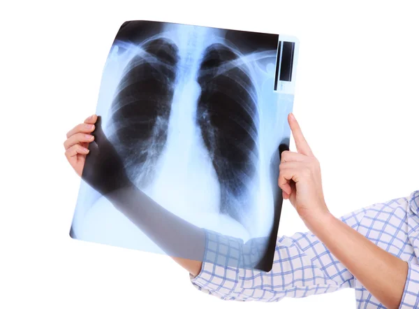 My lungs — Stock Photo, Image