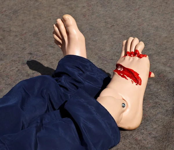 Mannequin with injury — Stock Photo, Image
