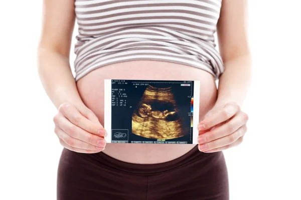 Těhotná žena s ultrazvukovým skenem — Stock fotografie