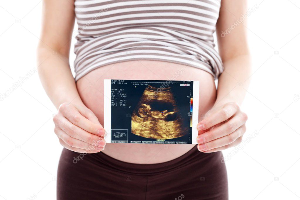 Pregnant woman with ultrasound scan