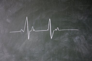 EKG işareti ile Tebeşir tahtaya çizilen