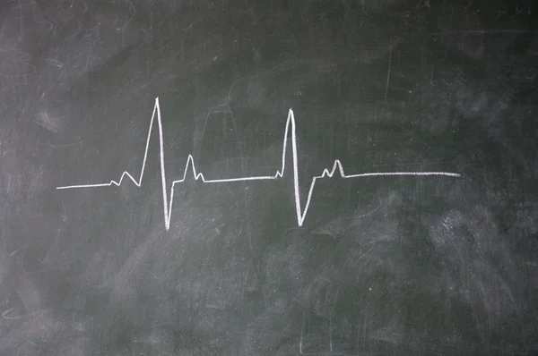 黒板にチョークで描かれた心電図記号 — ストック写真