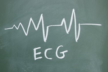 EKG işareti ile Tebeşir tahtaya çizilen