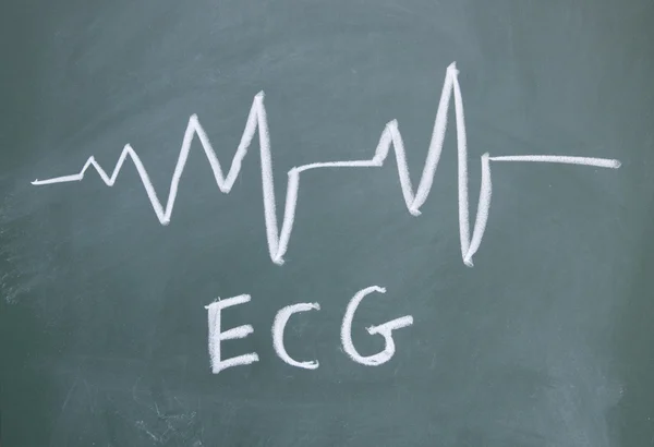 Signo de ECG dibujado con tiza en pizarra —  Fotos de Stock