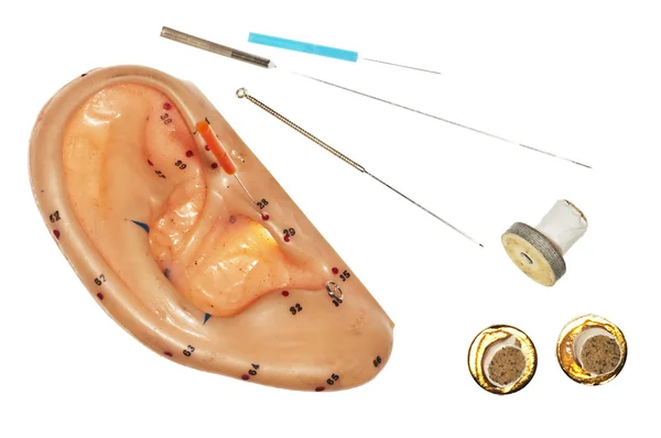 Акупунктура уха — стоковое фото