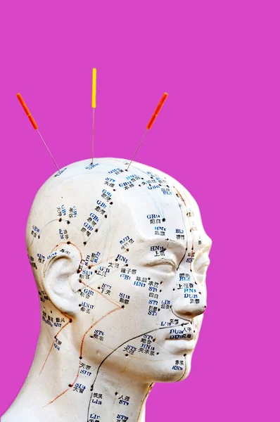Иголки иглоукалывания на модели головы — стоковое фото