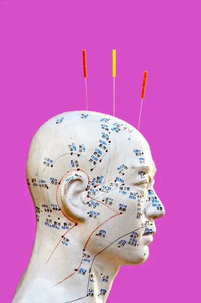 Igły do akupunktury na modelu głowy — Zdjęcie stockowe