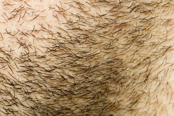 Sakal saç yüz büyüme — Stok fotoğraf