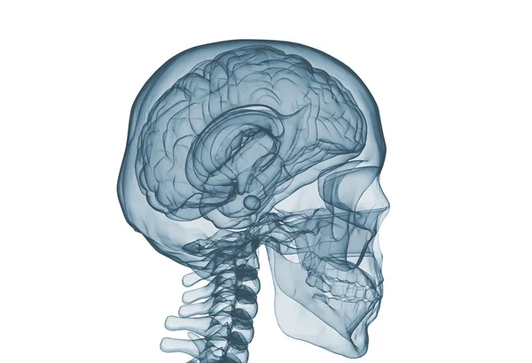 X ray görüntü üzerinde beyaz izole beyin ve — Stok fotoğraf