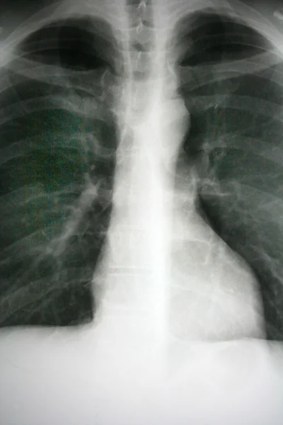 Рентгеновское изображение — стоковое фото