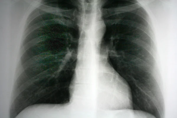 Imagem de raios-X — Fotografia de Stock