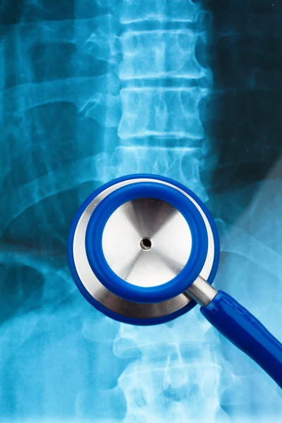 Stethoscope and x-ray. health. — Stock Photo, Image