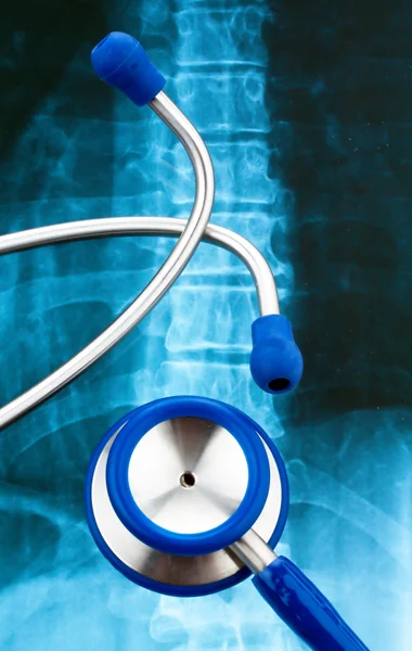 Stethoscoop en x-stralen. gezondheid. — Stockfoto