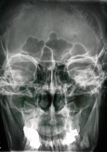 X-ray head — Stock Photo, Image
