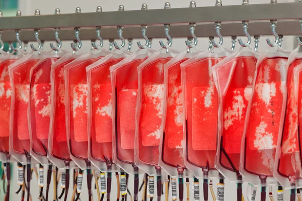 Кров з донорської крові в лабораторії крові — стокове фото