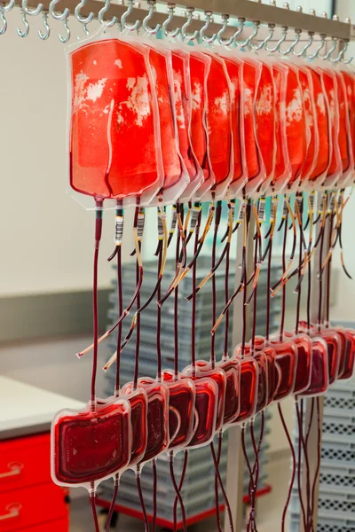 Кров з донорської крові в лабораторії крові — стокове фото